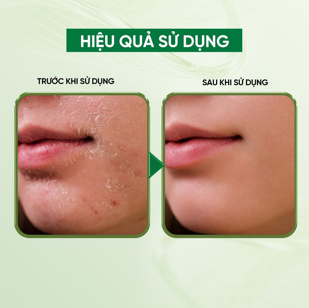 Bioessence Mask Pre - Mặt Nạ Rau Má Premium Dưỡng Ẩm, Làm Mềm Da, Làm Dịu Da | 10 Miếng x 30ML - Ảnh 4