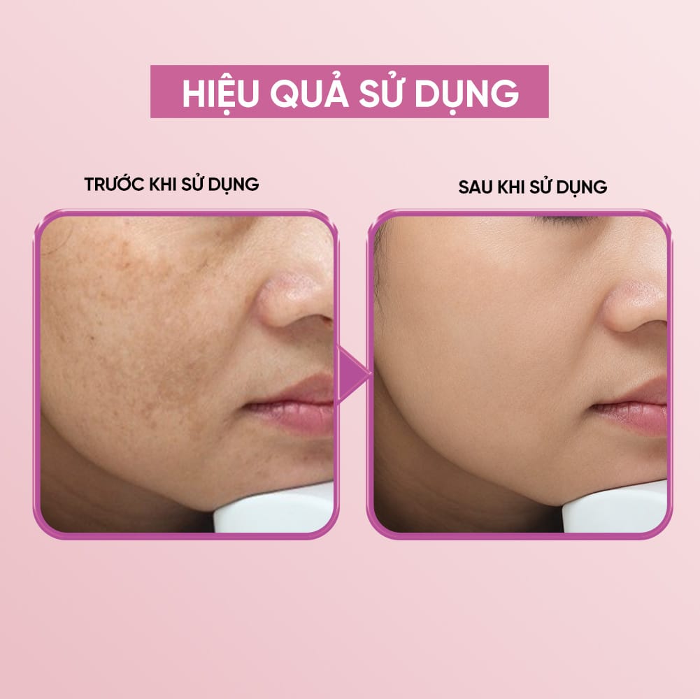 Spot white Essence - Serum Dưỡng Sáng Chuyên Sâu| Dưỡng Trắng Và Ngừa Lão Hóa Da - Ảnh 4